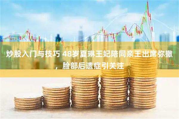 炒股入门与技巧 48岁夏琳王妃陪同亲王出席弥撒，脸部后遗症引关注